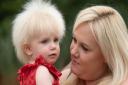 Charlotte Davis with her daughter Layla Davis, who has Uncontrollable Hair Syndrome.