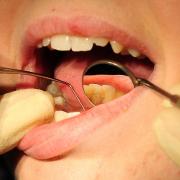 A new dentist centre will be open at the University of Suffolk